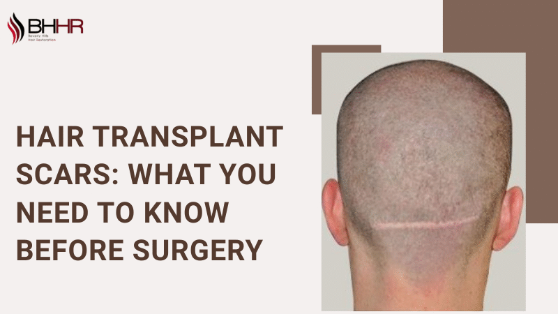Hair Transplant Scars: What You Need to Know Before Surgery