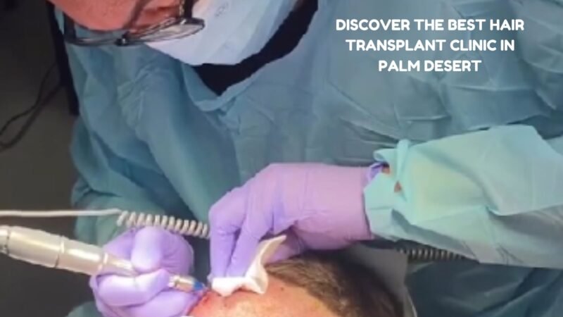 Discover the Best Hair Transplant Clinic in Palm Desert